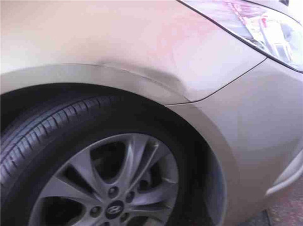 凹陷修復(fù)修復(fù)前